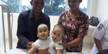 Kembar Siam Dempet Perut Asal Taput Akhirnya Pulang Kampung