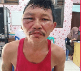 Gara-gara Mabuk Tuak, Warga Batubara Ini Perkosa Putri Kandungnya