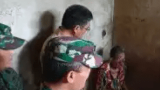 Nek Sarifati Laila Asal Nias Derita Penyakit Aneh, Wajahnya Membusuk