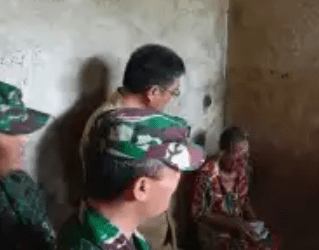 Nek Sarifati Laila Asal Nias Derita Penyakit Aneh, Wajahnya Membusuk