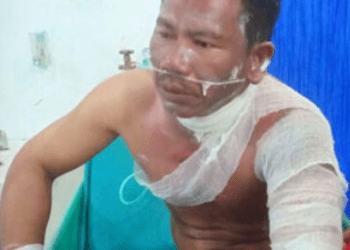 Penjual Ikan di Tanjungbalai Dibakar Adiknya