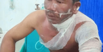 Penjual Ikan di Tanjungbalai Dibakar Adiknya