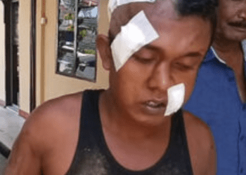 Merampok, Pria Ini Bonyok Dihajar Warga