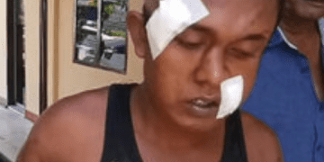 Merampok, Pria Ini Bonyok Dihajar Warga