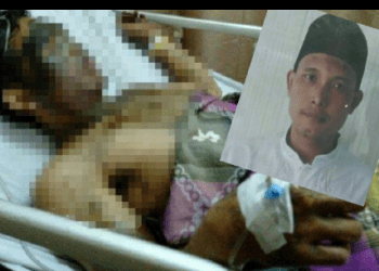 Guru Ngaji Ini Dibunuh Pakai Air Keras Oleh Selingkuhan Istrinya