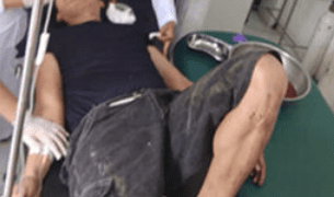 Ngebut Masuk ke Parit, Warga Batubara Tewas