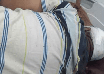 Dikeroyok di Siantar, Kepala Oknum Personel Polres Simalungun Berdarah-darah Dilarikan ke RS