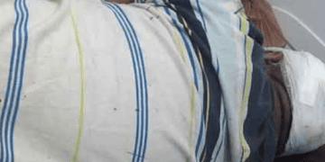 Dikeroyok di Siantar, Kepala Oknum Personel Polres Simalungun Berdarah-darah Dilarikan ke RS