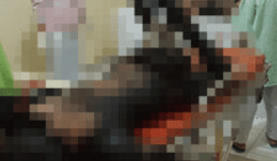 Kecelakaan Maut di Langkat, Tabrak Truk, Pengendara Sepedamotor Tewas Terpanggang