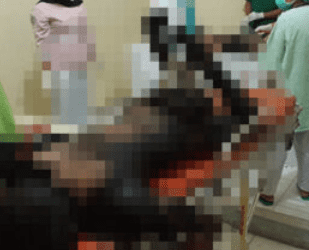 Kecelakaan Maut di Langkat, Tabrak Truk, Pengendara Sepedamotor Tewas Terpanggang