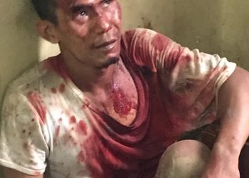 Wajah Penjambret Kalung Ini Berlumuran Darah