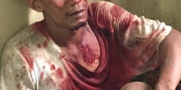 Wajah Penjambret Kalung Ini Berlumuran Darah