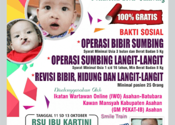 IWO Asahan dan GM Pekat IB Gandeng Smile Train Gelar Operasi Bibir Sumbing Gratis, Digelar Selama 3 Hari, 11 Hingga 13 Oktober