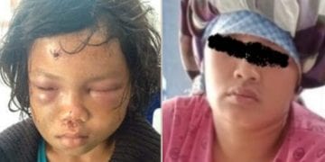 Aniaya Anaknya, Ibu di Simalungun Diperiksa Polisi, Petugas Polsek Lalai, Tersangka Kabur