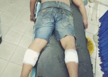 Tersangka Narkoba di Tanjungbalai Ditembak