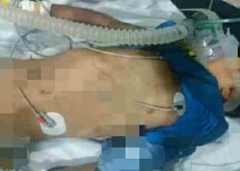 Pasangan Lesbian Tante Aniaya Bocah 7 Tahun