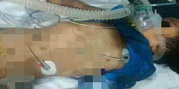 Pasangan Lesbian Tante Aniaya Bocah 7 Tahun