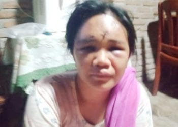 Wanita Penjual Parfum di Medan Diculik dan Dianiaya 7 OTK, Dibuang di Desa Suka Nalu