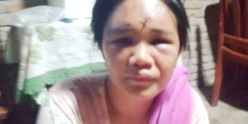 Wanita Penjual Parfum di Medan Diculik dan Dianiaya 7 OTK, Dibuang di Desa Suka Nalu