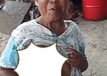 Wanita Penderita Tumor Ganas di Dadanya Menangis Mohon Bantuan, Ini Videonya