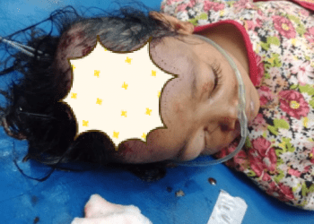 Bocah Ini Terserempet Kereta Api Siantar Ekspres