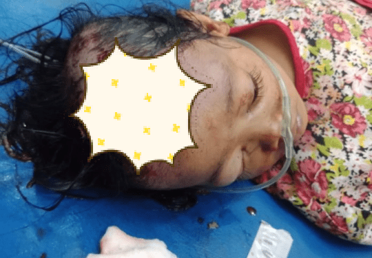 Korban yang teserempet kereta api saat mendapat perawatan medis.