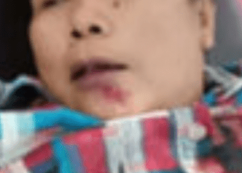 Ibu Asal Batubara dan Anaknya Jadi Korban Tabrak Lari di Simalungun, Si Anak Tewas