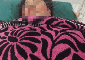 Warga Labura Tewas Ditabrak Pengendara Sepedamotor di Tebing Tinggi