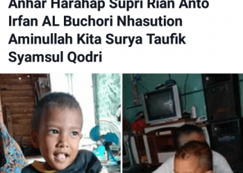 Bocah Penderita Tumor di Perut Harapkan Bantuan Bupati Asahan