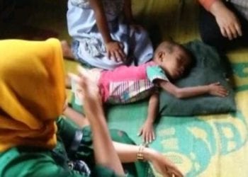 Bocah pemakan sabun di Tapsel