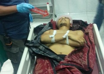 Kepala Brigadir Doni Tertembus Peluru di Barak Polisi