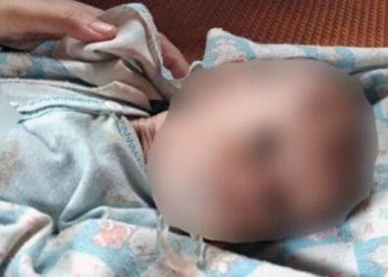 Bayi di Tapsel yang dianiaya Ibunya