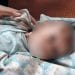 Bayi di Tapsel yang dianiaya Ibunya