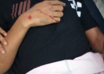 Kawasaki Ninja Vs Kanjen, Dua Pengendara Sepedamotor Luka-luka