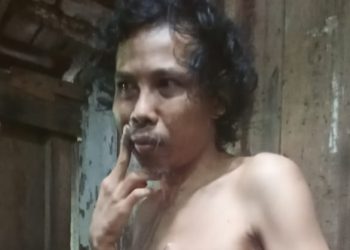 Warga Jalan Merak Asahan Dipasung Keluarga