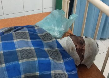 Tak Terima Anaknya Dimarahi, Istri Bakar Suami