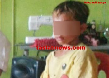 Dituduh Curi HP, Bocah Piatu di Asahan ini Disiksa 5 Warga, Leher Ditempel Besi Panas