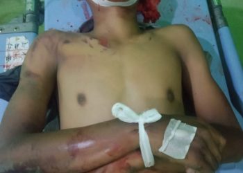 Tabrakan, 2 Pengendara Sepedamotor Tewas