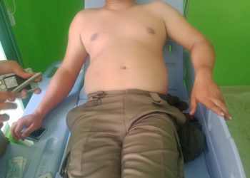 Mobil Satpol PP Pemprovsu Tabrak Pembatas Jalan Tol, 3 Penumpang Luka-luka