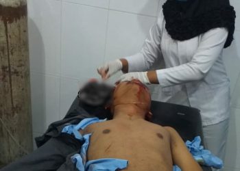 Tabrak Truk Colt Disel, Pengendara Sepedamotor Luka Berat