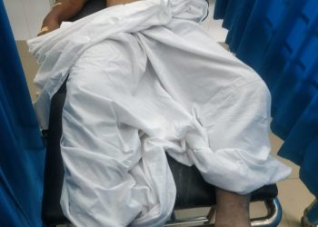 Curi Sepedamotor, 2 Pria Ini Diamuk Massa