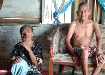 Derita Penyakit Mirip Tumor, Nek Muriatik Butuh Uluran Tangan Dermawan