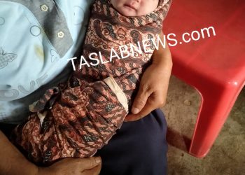 Ini Wajah Bayi yang Dibuang di Areal Perkebunan di Bandar Pulau Asahan