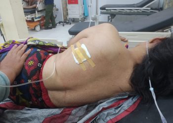 Lagi Ngutip Berondolan Sawit, Punggung Warga Aek Loba Asahan Ditembak