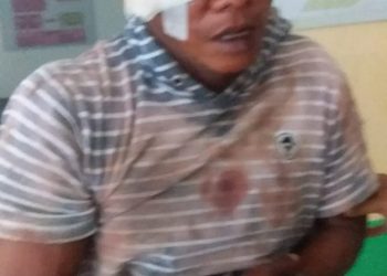 Wajah Pria Ini Bonyok Dihajar Warga