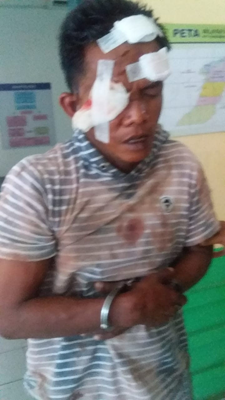 Wajah Pria Ini Bonyok Dihajar Warga