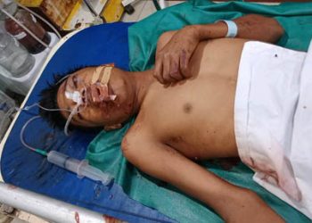 Honda Beat vs Kawasaki Ninja, Kedua Pengendara Tewas di TKP