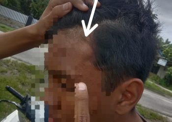 Siswa SMA di Kisaran Ini Dikroyok di Dekat Alun-alun 