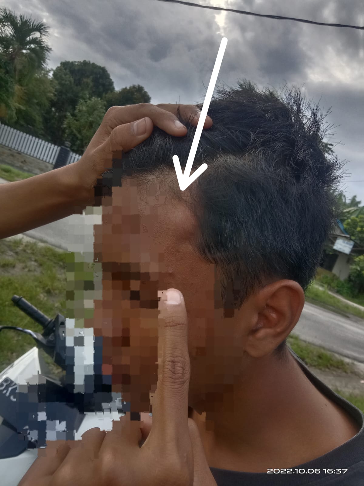 Siswa SMA di Kisaran Ini Dikroyok di Dekat Alun-alun