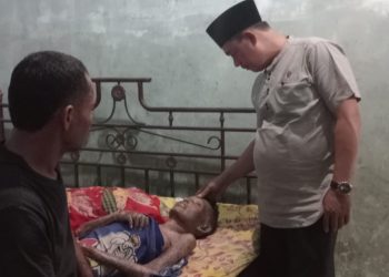 Tolong Pak Bupati Asahan dan Kapolres, Yeni Sudah 2 Tahun Menderita Penyakit Kulit